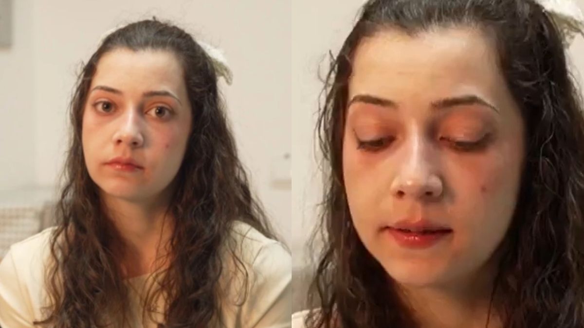 Noelia zostanie poddana eutanazji