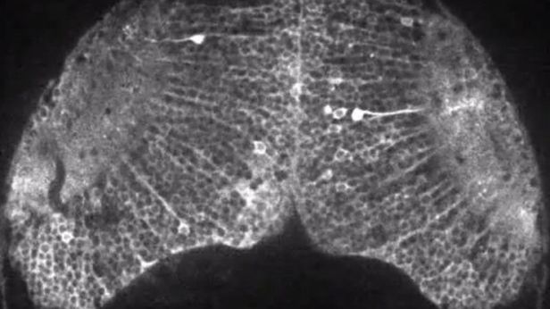 Tak wygląda formująca się myśl w obiektywie kamery 1