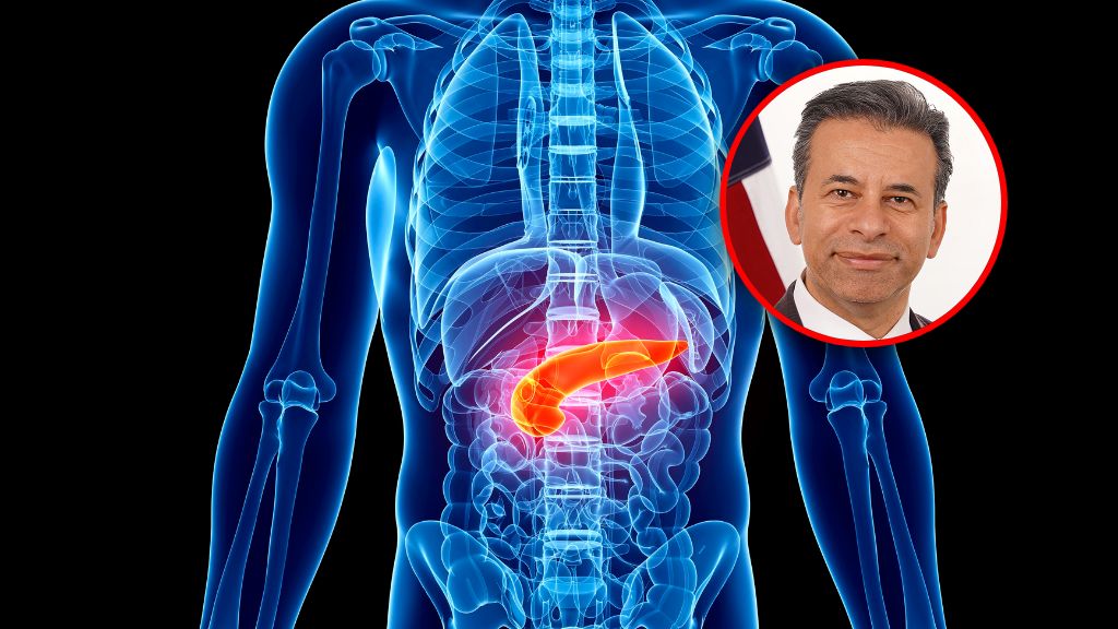 "Rak trzustki jest jednym z najtrudniejszych do leczenia"