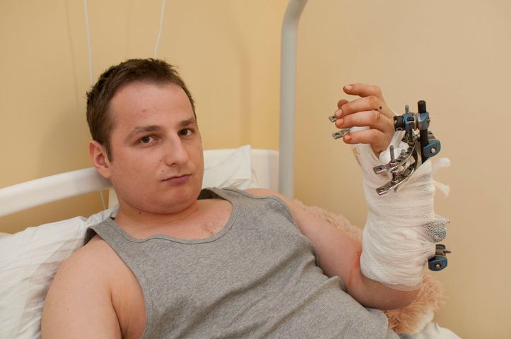 Pacjentowi przyszyto niemalże amputowaną dłoń