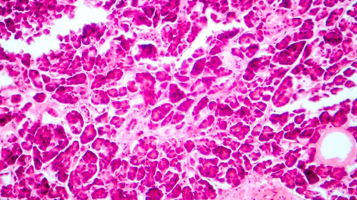 Wysepki Langerhansa, inaczej wyspy trzustkowe, to skupiska komórek pełniących funkcje endokrynne.