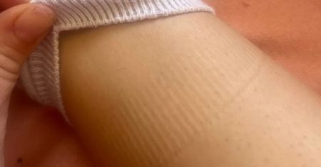 Widzisz takie ślady po skarpetkach? Lepiej to przeczytaj