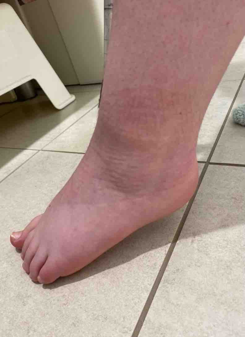 Atak może nastąpićw każdej chwili