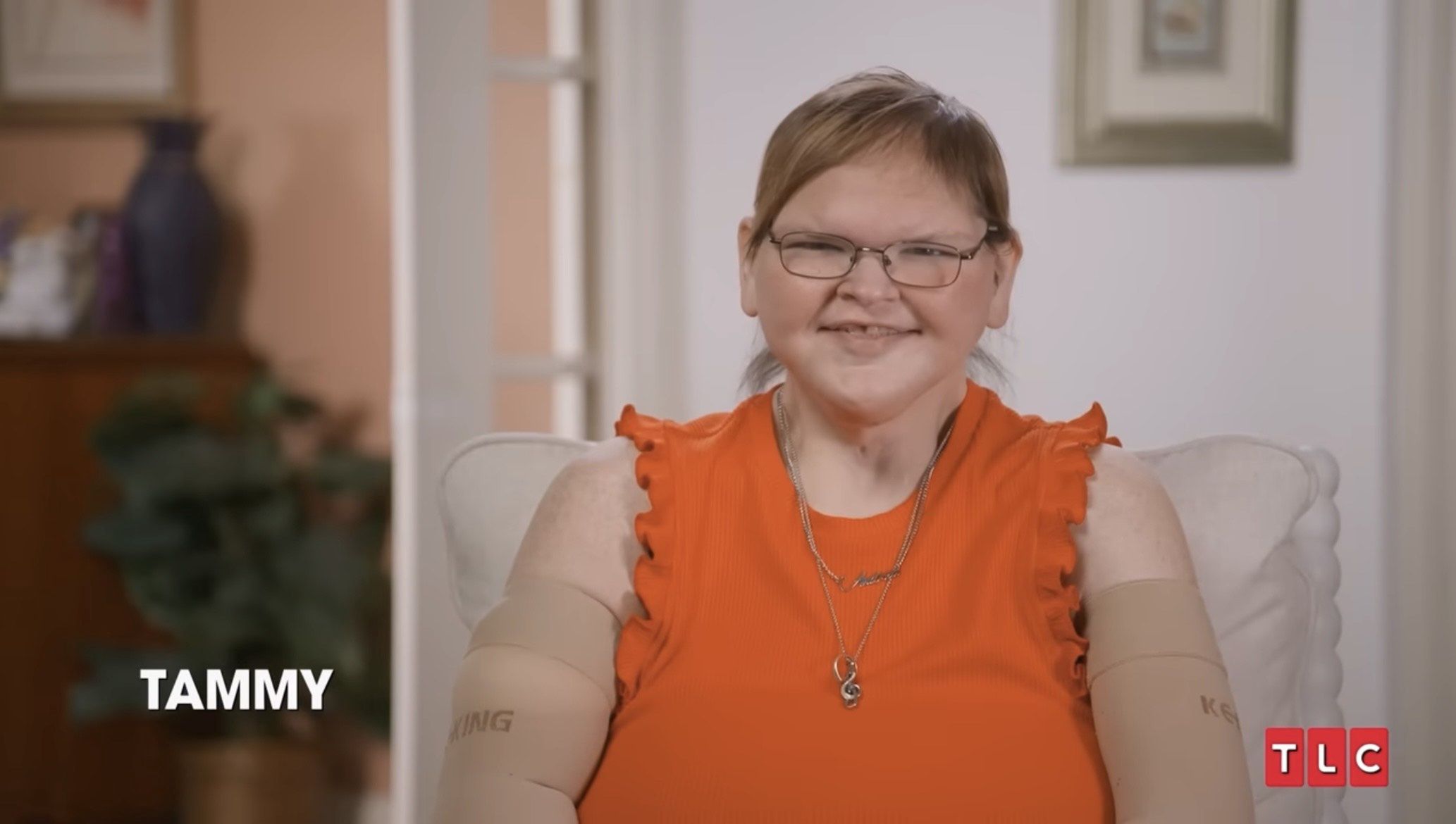 Tammy Slaton po operacji usuwania skóry