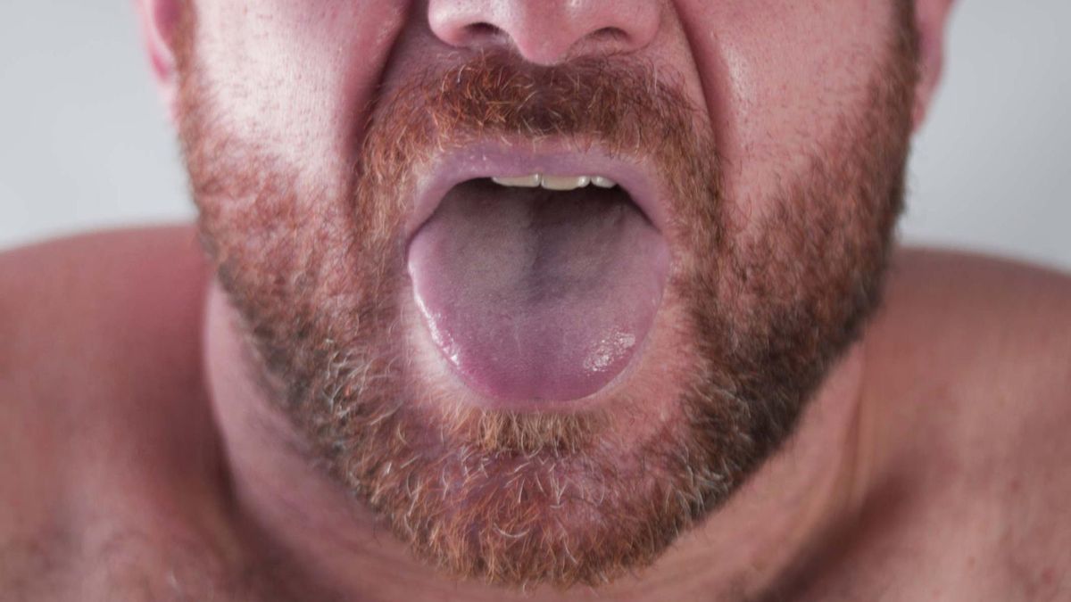 Nie bagatelizuj objawów. Choroba może doprowadzić do sepsy