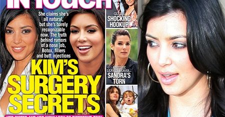 Kim Kardashian miała operację plastyczną?!