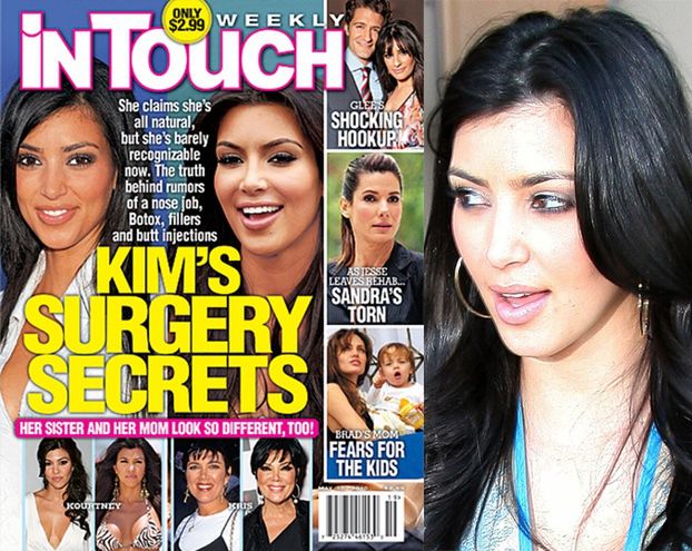 Kim Kardashian miała operację plastyczną?!