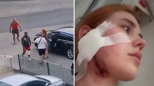Brutalne pobicie młodej pary. 20-latka dostała ciosy w twarz za akcent