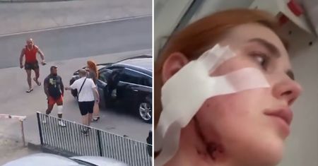 Brutalne pobicie młodej pary. 20-latka dostała ciosy w twarz za akcent