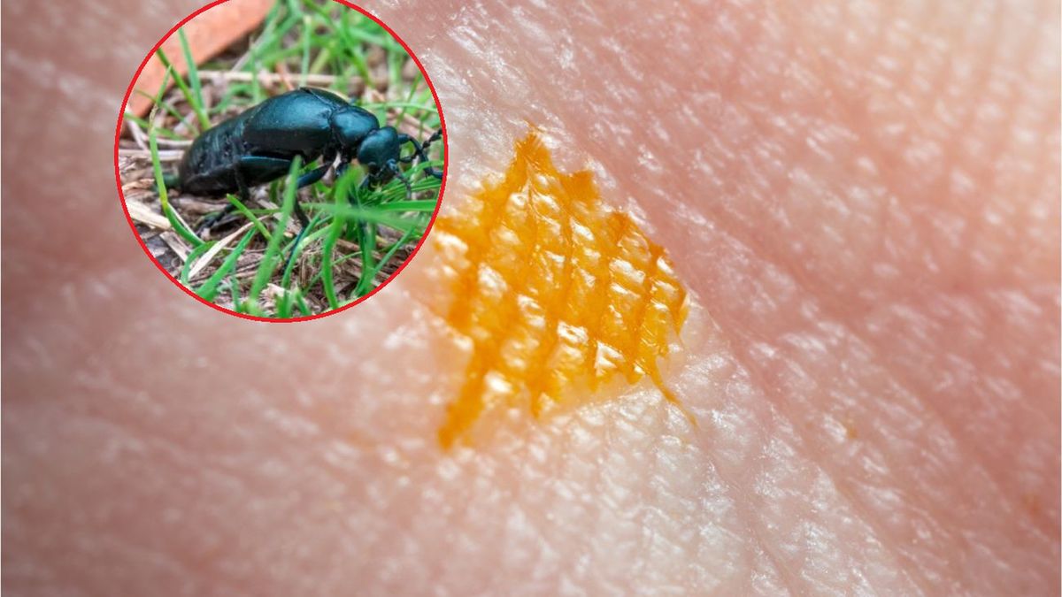 Oleice preferują siedliska trawiaste na nasłonecznionych terenach