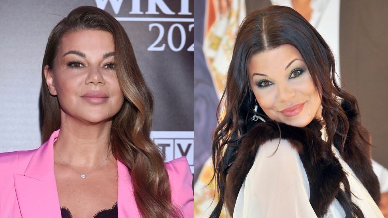 Edyta Górniak korzystała z zabiegów medycyny estetycznej? Ekspert ocenia