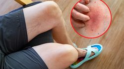 Najczęstszy symptom groźnej choroby. Lekarz ostrzega, by nie bagatelizować swędzących nóg