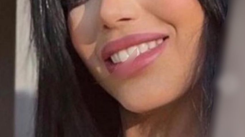 Jak wyglądała przed operacjami plastycznymi? Nie do poznania...