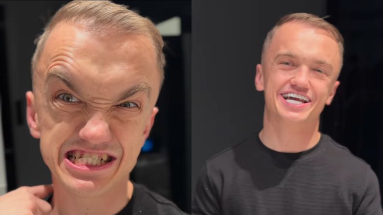 Mini Majk zaprezentował odmieniony uśmiech