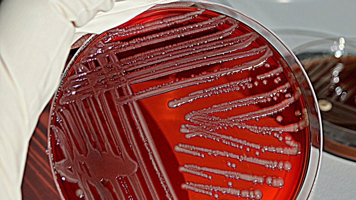 Bacterial cuture
Bacteria grown on a blood agar plate.
Scharvik
Klebsiella Pneumoniae, Pathogen, Agar Jelly, Klebsiella, Urinary Tract Infection, Antibiotic, Microbiology, E. coli, Red, Science, Research, Human Hand, Bacterium, Petri Dish, Table