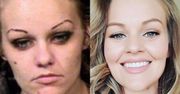 Pokonała uzależnienie od heroiny. Pokazuje jak się zmieniła