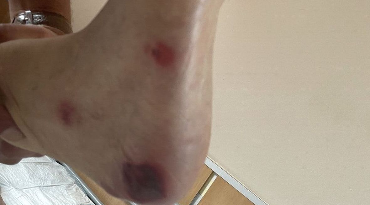 "Kiedy przywieziono tatę ze szpitala, nie miał na ranach żadnych opatrunków" 