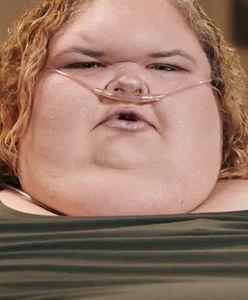 "Siostry wielkiej wagi". Uczestniczka programu trafiła do szpitala. "Jej płuca się poddały"