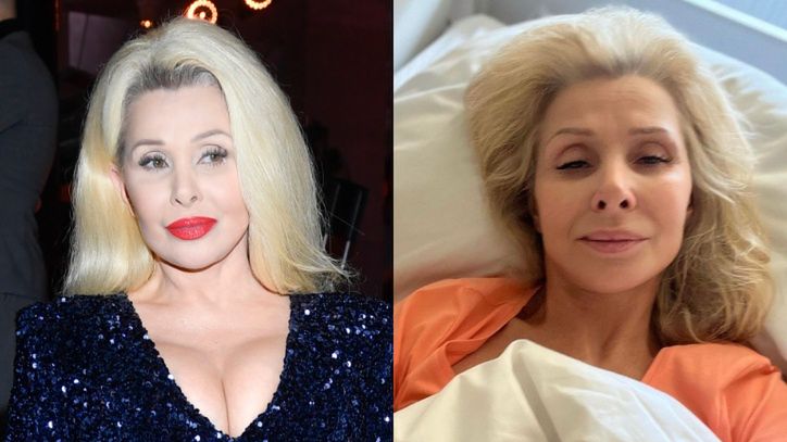 Aldona Orman przeszła trzecią operację tętniaka mózgu