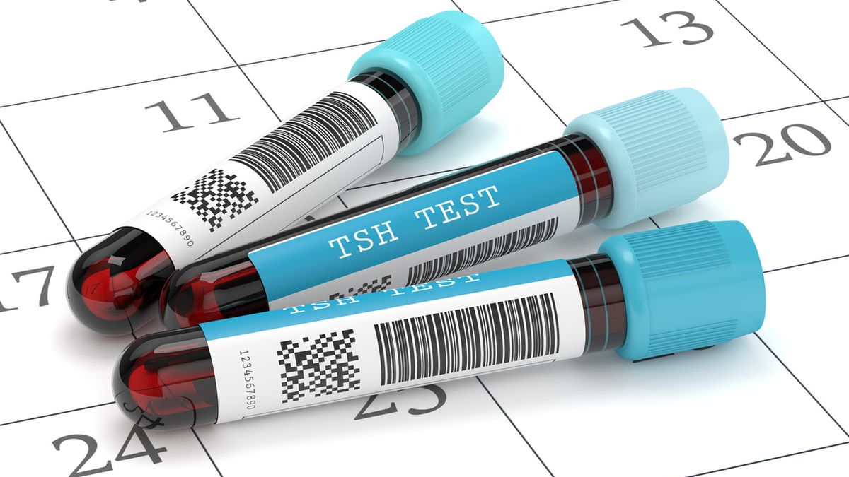 Norma TSH dla 20-latki jest inna, niż dla osób starszych i znacznie odbiega od ogólnie przyjętych norm laboratoryjnych