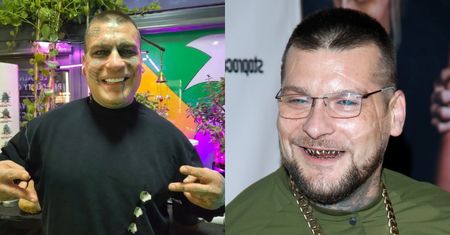 Popek chwali się NOWYMI ZĘBAMI, szczerząc się na Instagramie. Zmiana na plus? (FOTO)