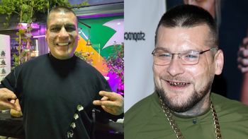 Popek chwali się NOWYMI ZĘBAMI, szczerząc się na Instagramie. Zmiana na plus? (FOTO)