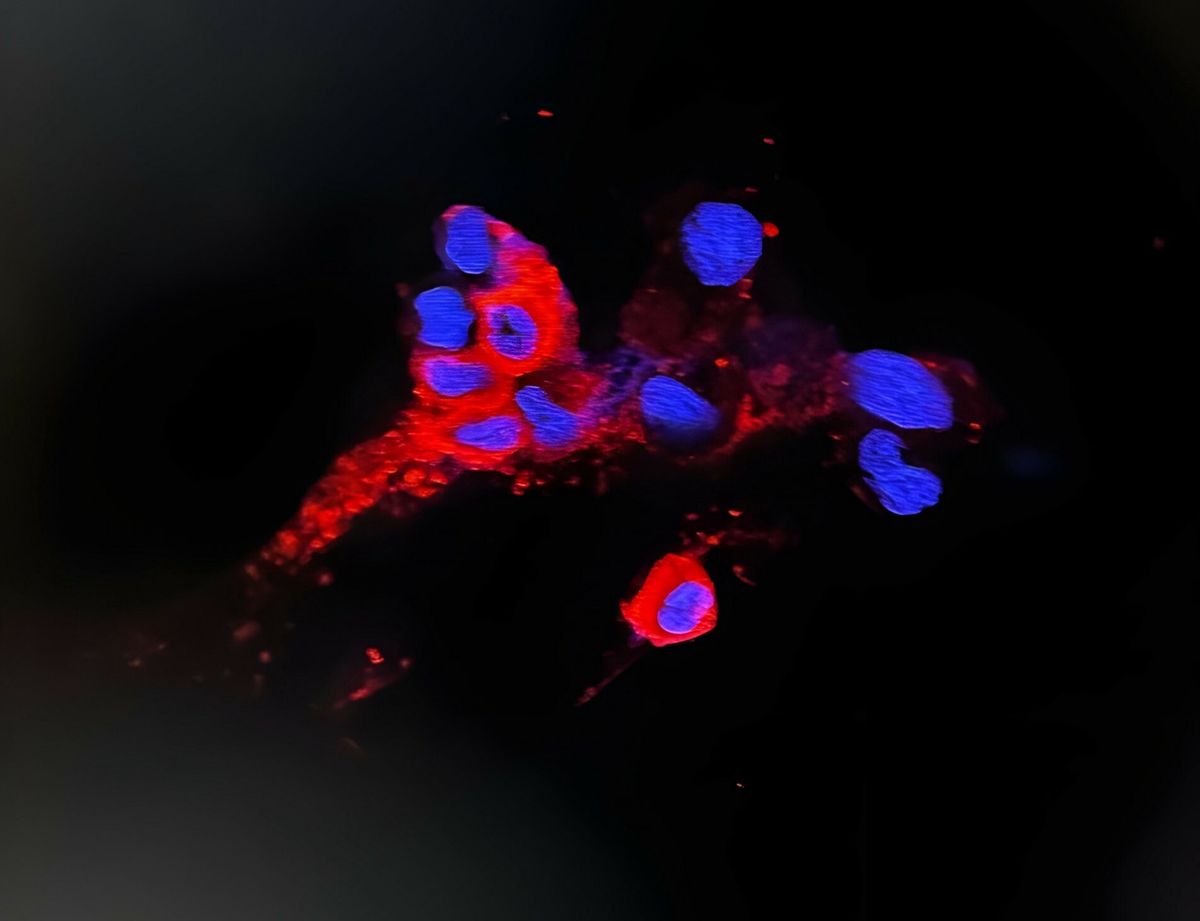 Omikron widziany pod mikroskopem, fot. DPT OF MICROBIOLOGY HKU / LPN / IMAGE POINT FR/BSIP 