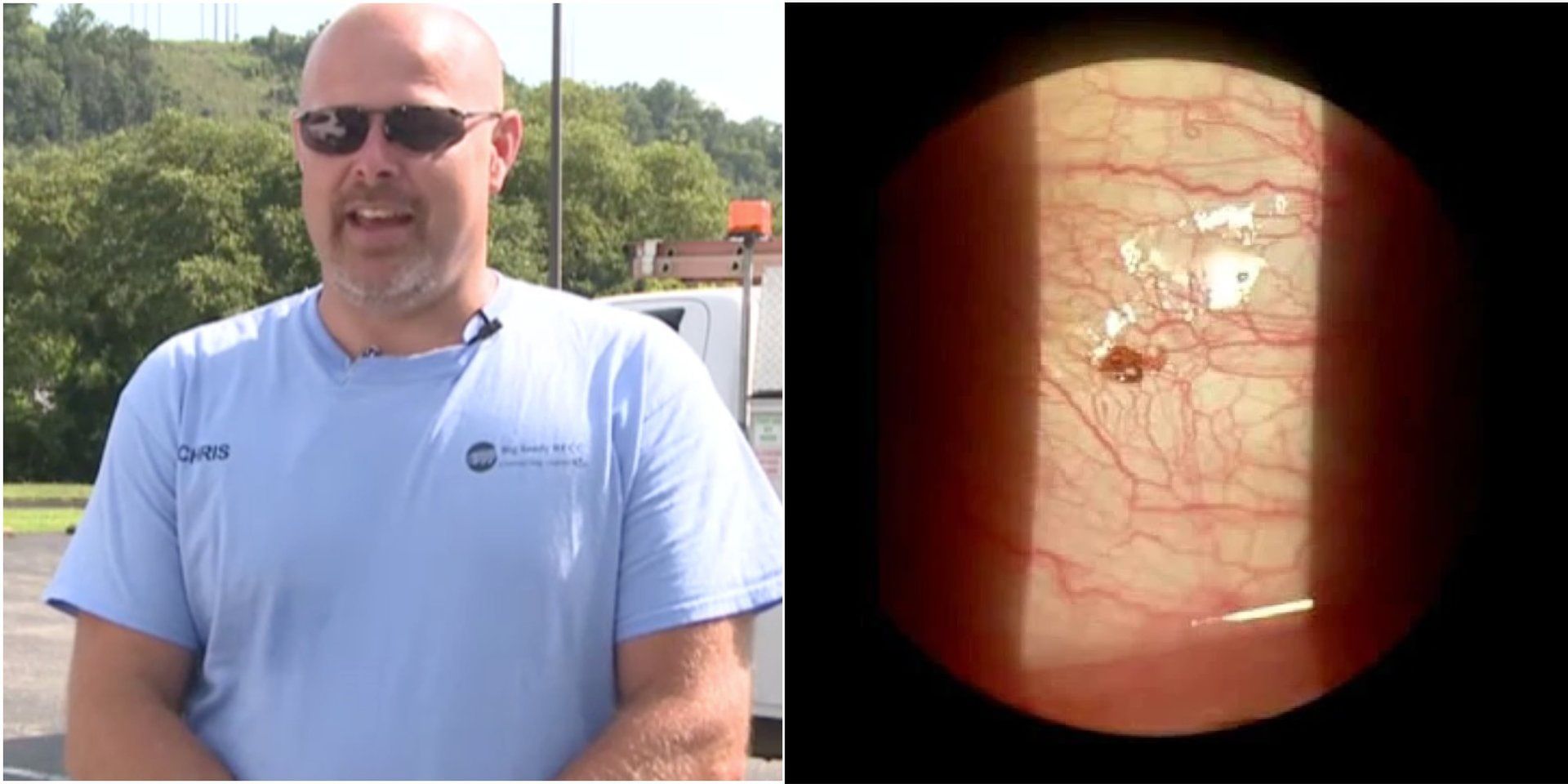 Kleszcz w przypadku mężczyzny wbił się w oko