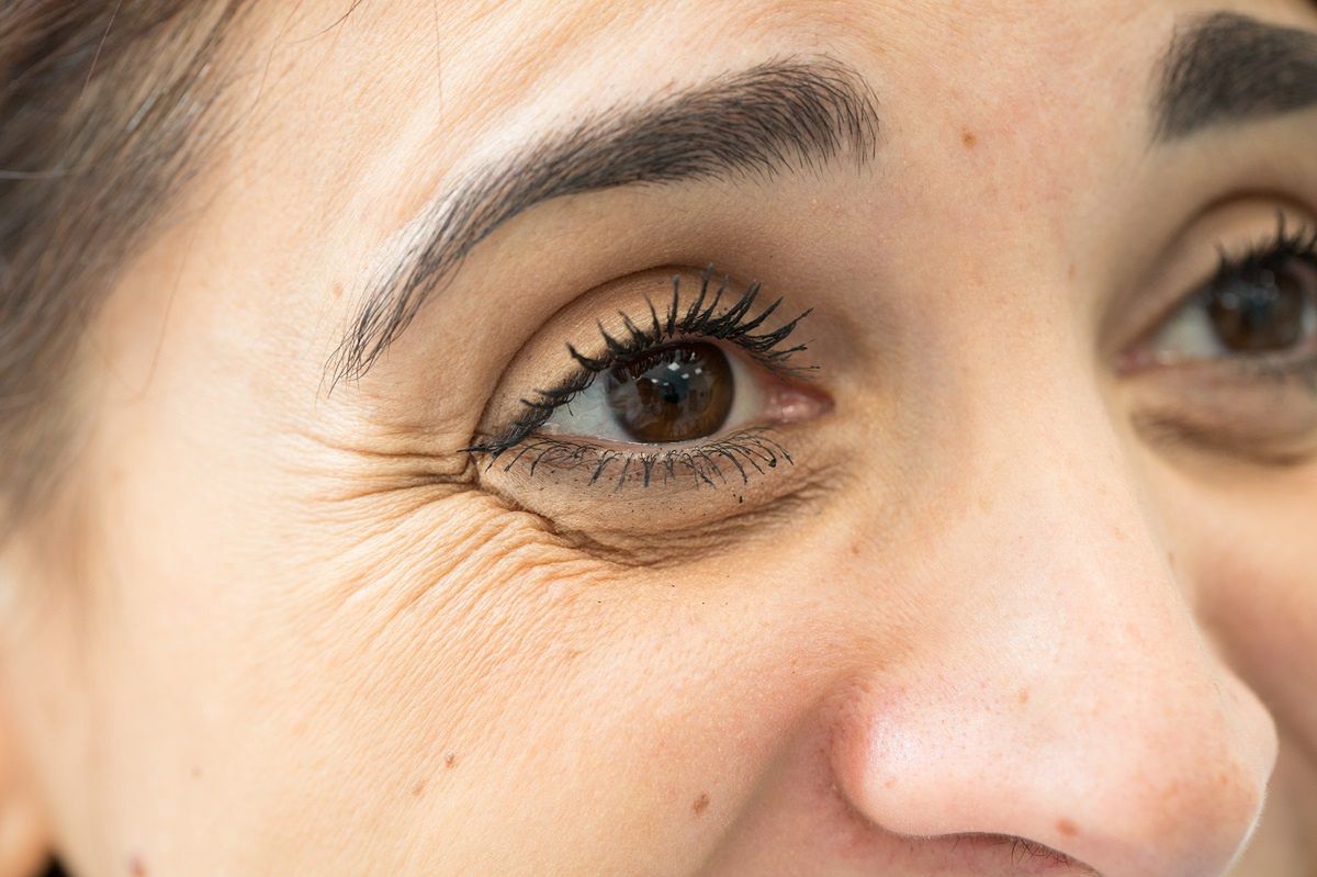Natural remedies to banish dark circles and eye bags
