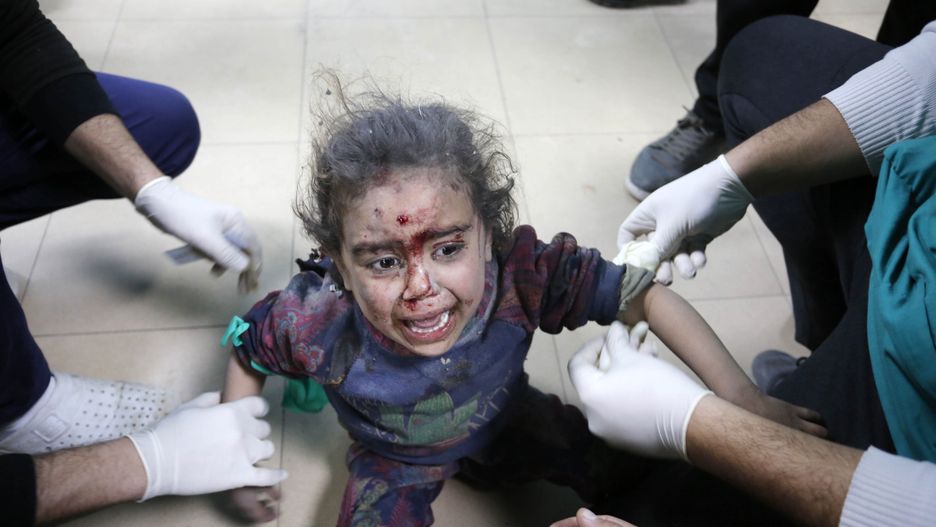 Dziewczynka ranna w izraelskim bombardowaniu Strefy Gazy