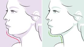 Przedstawiamy najlepsze ćwiczenia, dzięki którym zapomnisz o podwójnym podbródku