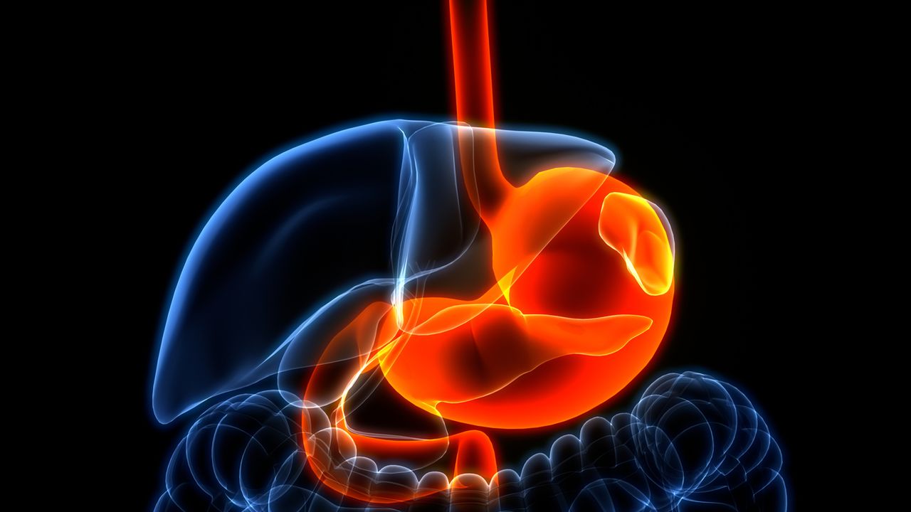 Rak dwunastnicy - przyczyny, objawy, rozpoznanie, leczenie