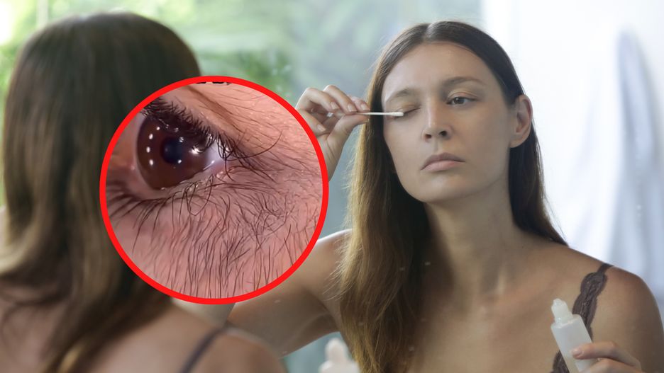 Działania niepożądane stosowania serum do rzęs