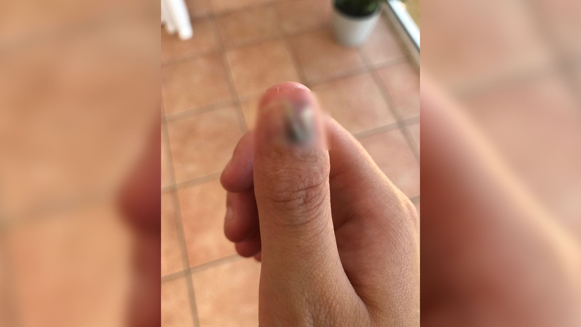 Palec Courtney wyglądał bardzo źle