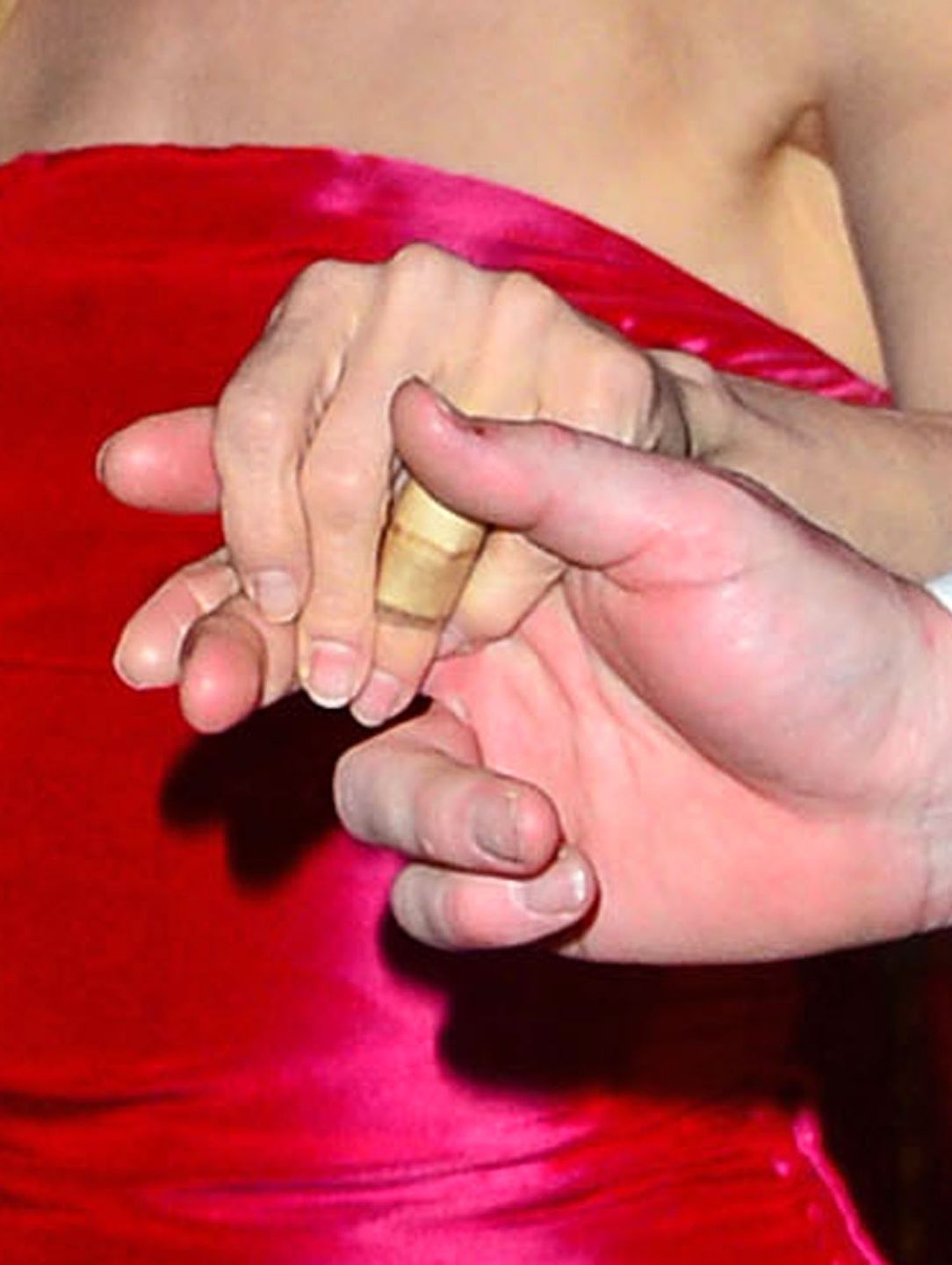 Tajemniczy plaster na palcu Renee