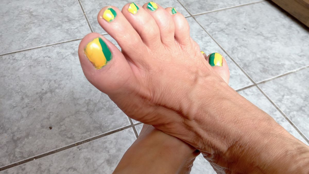 Jakie objawy daje wysoki cholesterol?