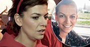 Alżbeta Lenska przeszła operację mózgu. Jej życie zmieniło się diametralnie, ale tylko na chwilę [WIDEO]