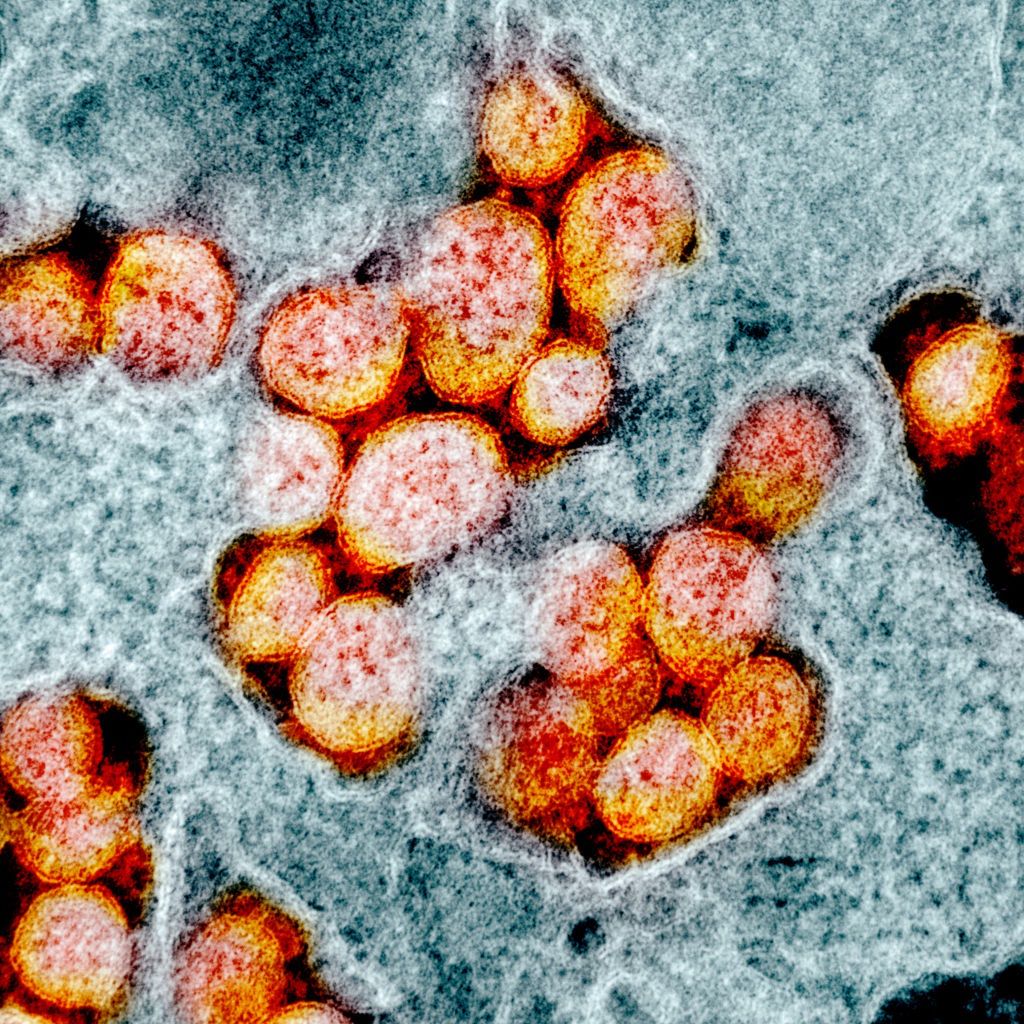 Koronawirus SARS-CoV-2 widziany pod mikroskopem