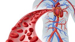 Ocena krążenia żylnego - czym jest i na czym polega?