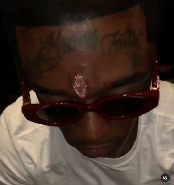 Lil Uzi Vert wszczepił sobie w czoło diament wart 24 miliony dolarów
