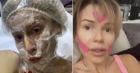 Jak gwiazdy dbają o urodę? Ulubione zabiegi gwiazd show-biznesu