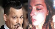Johnny Depp oskarża Amber Heard: "Namalowała sobie siniaki!"