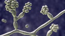 Mycetoma - przyczyny, objawy i leczenie