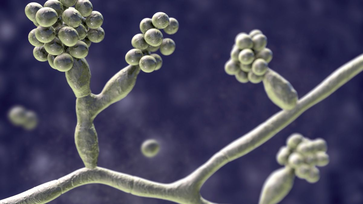 Mycetoma jest przewlekłą i postępującą chorobą zakaźną skóry i tkanki podskórnej, choć może zająć także mięśnie i kości.