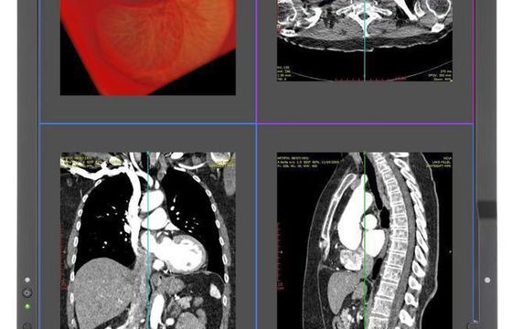 MDC212C2 - nowy monitor medyczny z nowej serii Medical Display Clinical od NEC