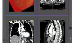 MDC212C2 - nowy monitor medyczny z nowej serii Medical Display Clinical od NEC