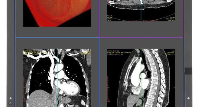 MDC212C2 - nowy monitor medyczny z nowej serii Medical Display Clinical od NEC
