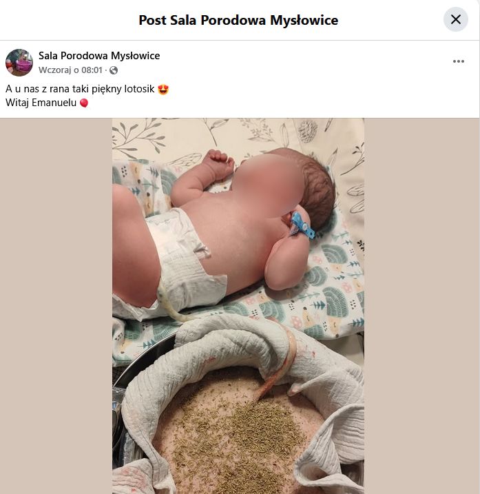 Zdjęcie noworodka z łożyskiem