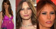 Melania Trump o operacjach plastycznych: "NICZEGO NIE ROBIŁAM! Prowadzę zdrowy tryb życia"