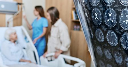 Białko odpowiedzialne za alzheimera wyleczy raka? Przełomowe badanie